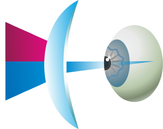 Illustration of blue light passing through the lens to an eye